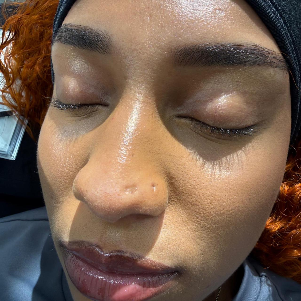 Photo après prestation esthétique